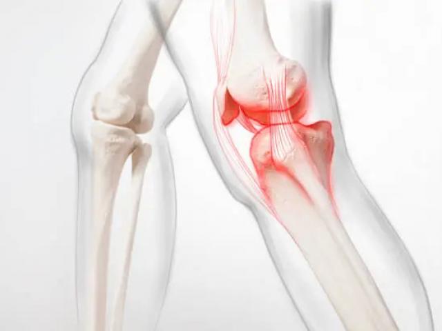 Syndrome fémoro‑patellaire, ménisque, tendinite : quand consulter un ostéo pour votre genou ?